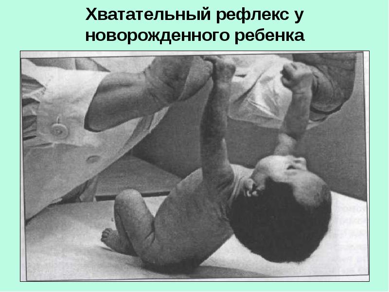 Родовая травма презентация