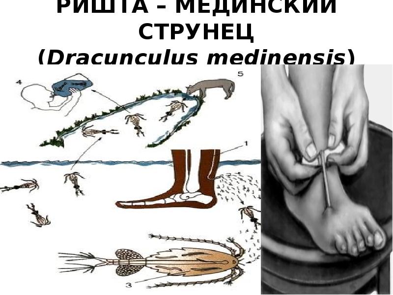 Схема цикла развития ришты