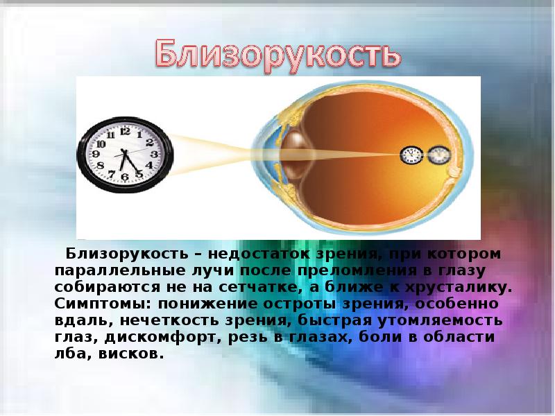 Дополните предложение изображение в близоруком глазу