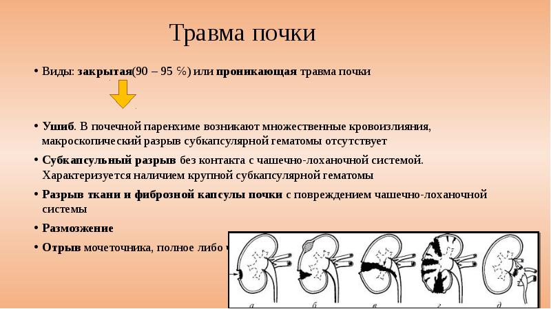 Травмы органов мочевыделительной системы презентация