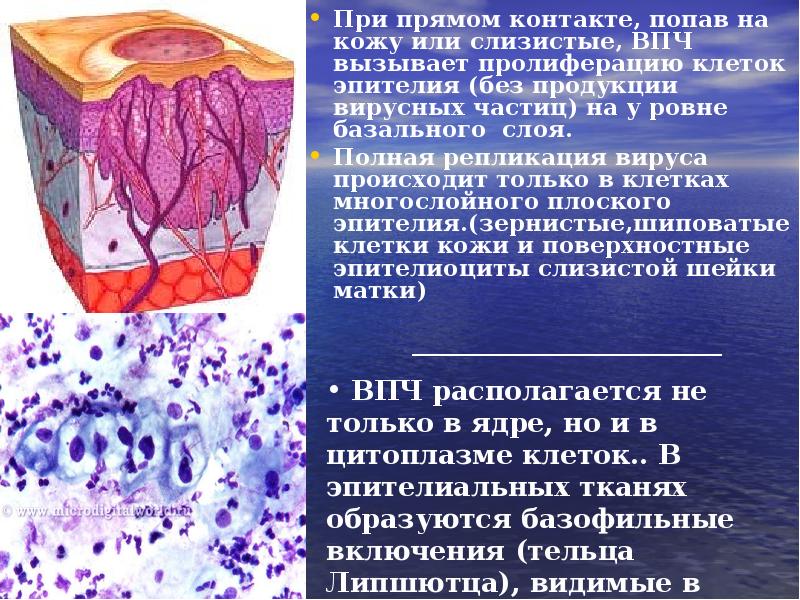 При прямом контакте, попав на кожу или слизистые, ВПЧ вызывает пролиферацию При прямом контакте, попав на кожу или слизистые, ВПЧ вызывает пролиферацию