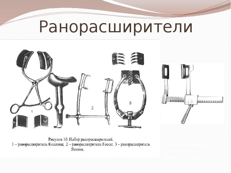 Ранорасширители Ранорасширители