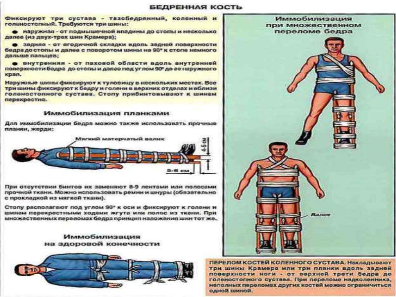 Первая помощь при переломах методический план