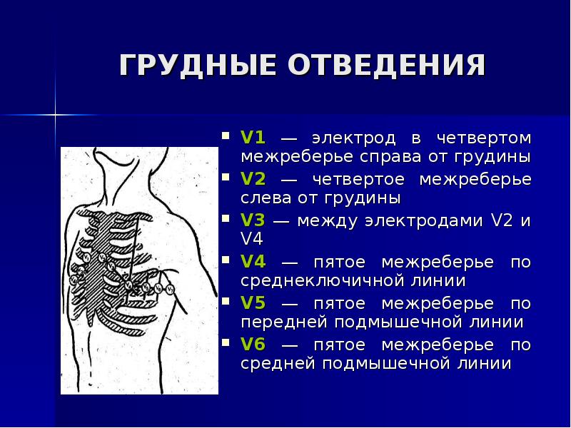 Регистрация сердца