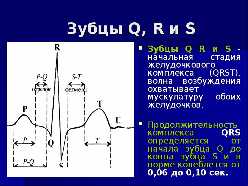 Изменение зубца q. Комплекс QRST на ЭКГ. Нормальная Продолжительность комплекса QRS составляет. Амплитуда комплекса QRS В норме. ЭКГ амплитуда комплекса QRS.
