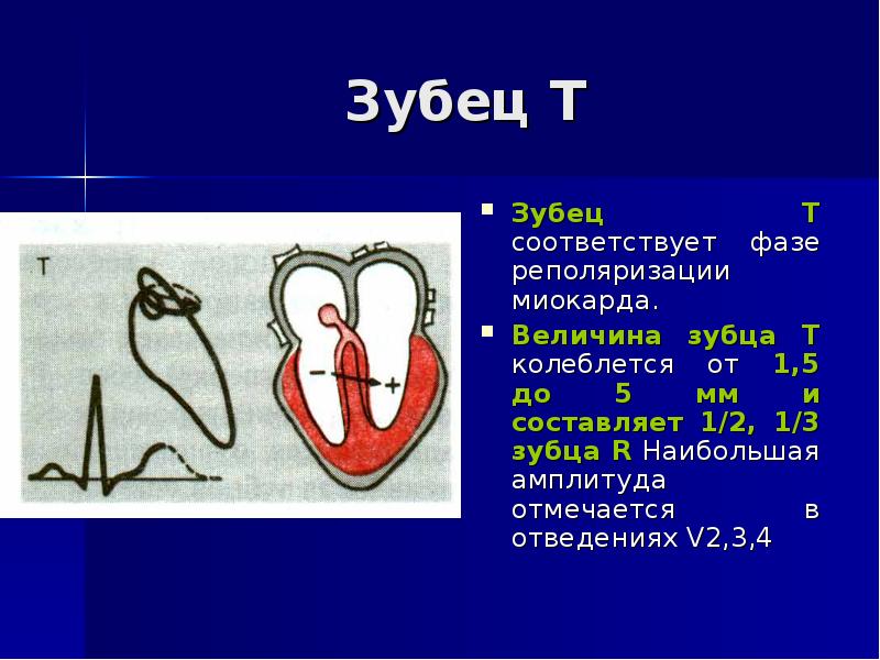 Зубец т. Зубец т на электрокардиограмме соответствует. Зубцы сердца. Величина зубца r. Зубец т на сердце.