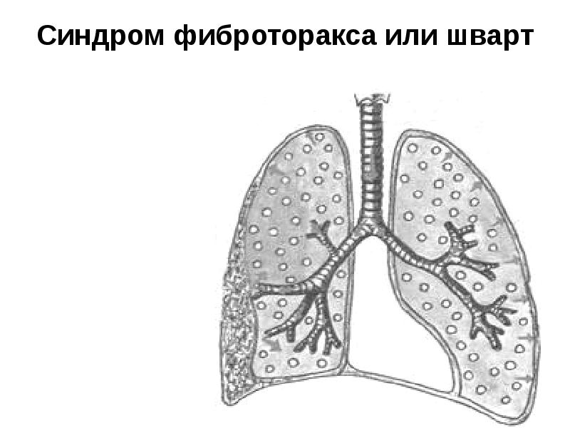 Патология дыхательной системы презентация