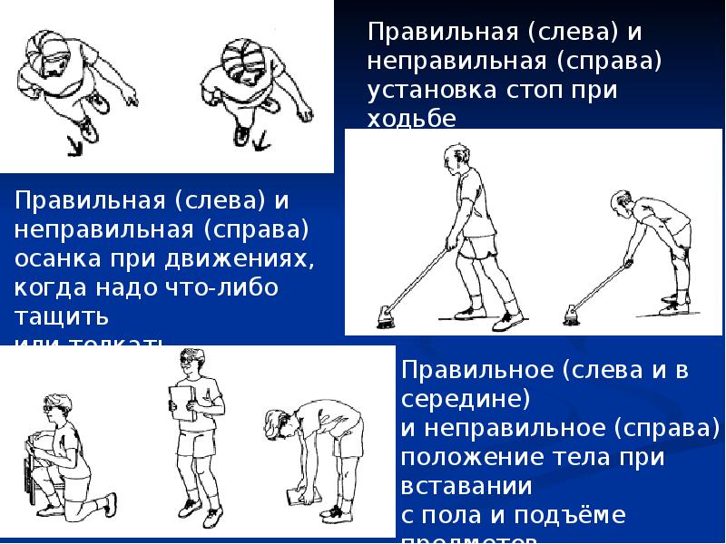 Левый правильный. Правильная походка при ходьбе. Правильное положение стопы при ходьбе. Неправильное положение стоп при ходьбе. Неправильная ходьба.