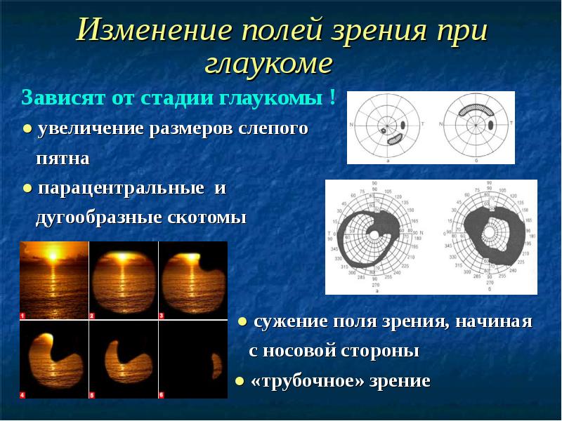 Изменение полей зрения