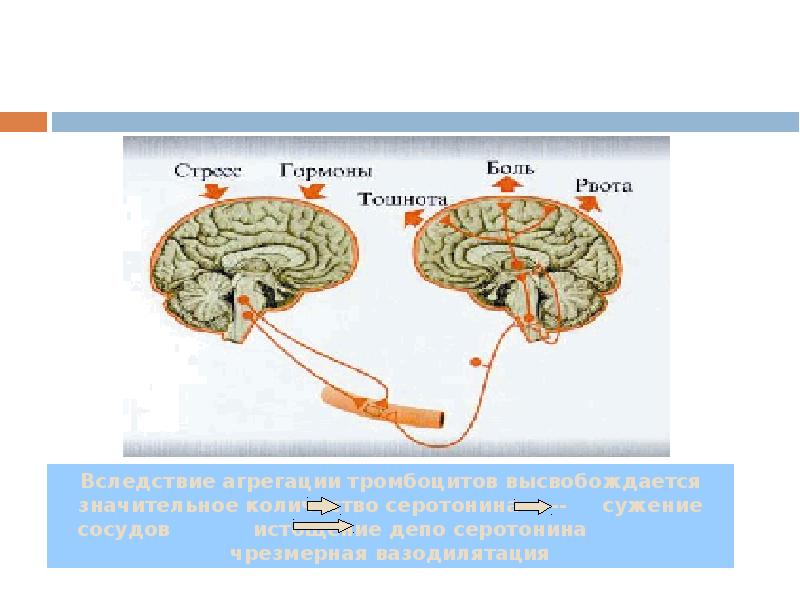 Презентация по неврологии на тему головные боли