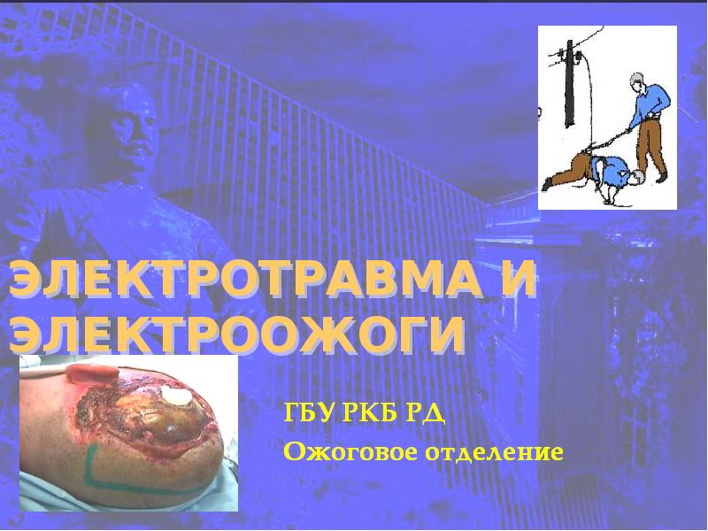 Ожоги электрическим током презентация