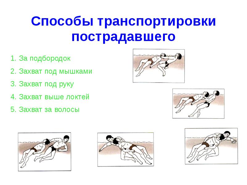 Предположите способ. Способы транспортировки пострадавших. Способы транспортировки пострадавшего. Какие существуют способы транспортировки пострадавшего. Способы транспортировки пострадавшего на воде.