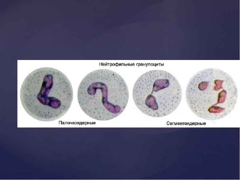 Палочкоядерные. Нейтрофильные гранулоциты. Нейтрофильные гранулоциты функции. Нейтрофильные гранулоциты строение. Электронограмма сегментоядерные гранулоциты.