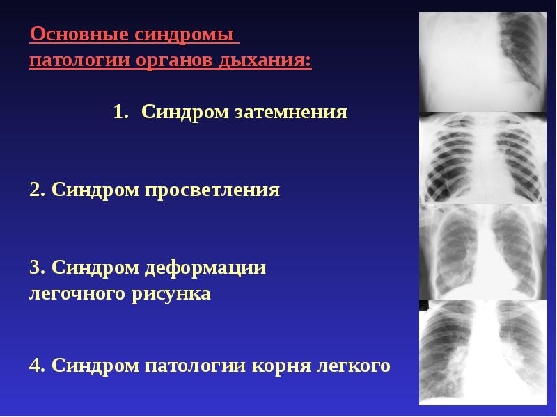 Патология легочного рисунка на рентгенограмме