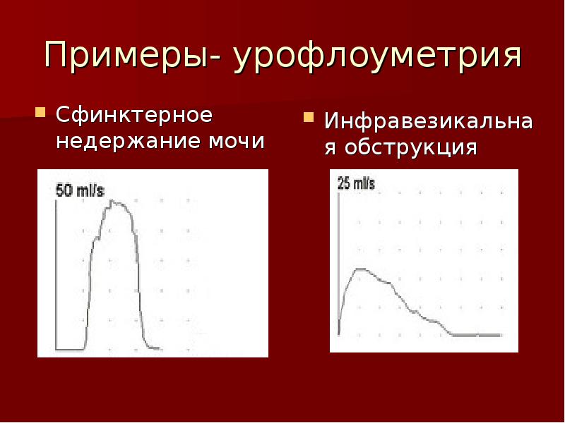 Уродинамические методы исследования в урологии презентация