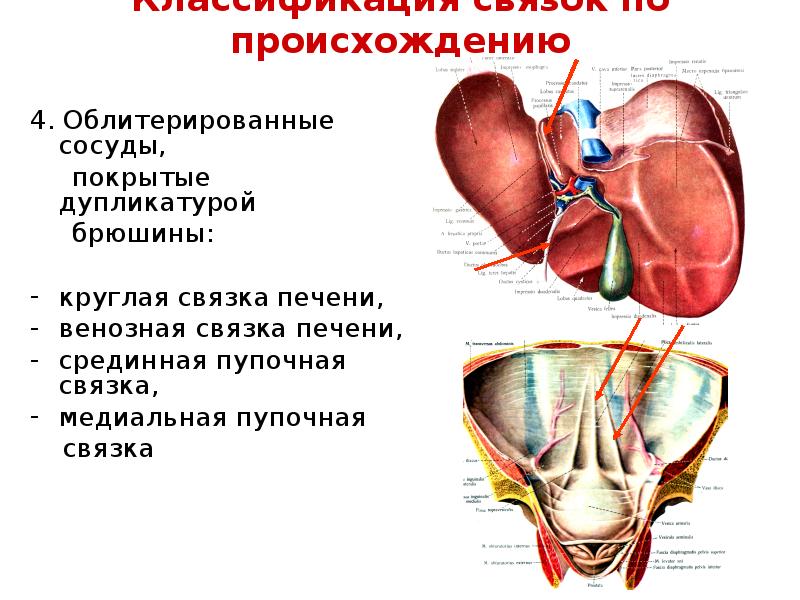 Синусы облитерированы. Блокада круглой связки печени. Связки брюшины анатомия. Круглая и венозная связка печени.