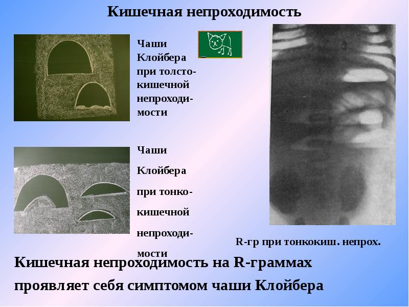 Непроходимость чаши