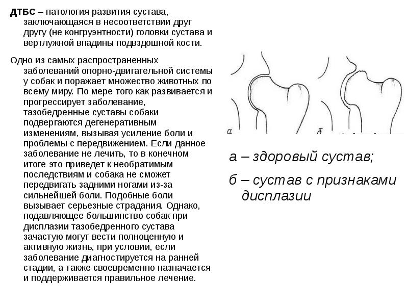 Дисплазия тазобедренного сустава у детей презентация