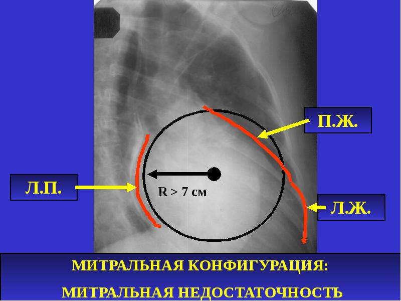 Лучевая диагностика сосудов. Лучевые методы исследования сердечно-сосудистой системы. Бифуркация аорты располагается на уровне. Лучевая диагностика заболеваний сердца и сосудов. Лучевая диагностика сосудов.