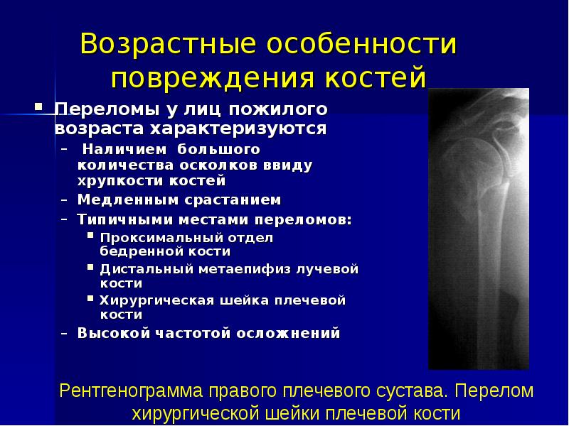 Проксимальной слабости. Возрастные особенности переломов. Перелом плечевой кости сросся. Возрастные особенности переломов костей. Перелом плечевого сустава.