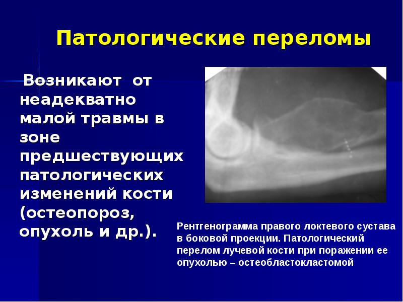 Лучевая диагностика костей презентация