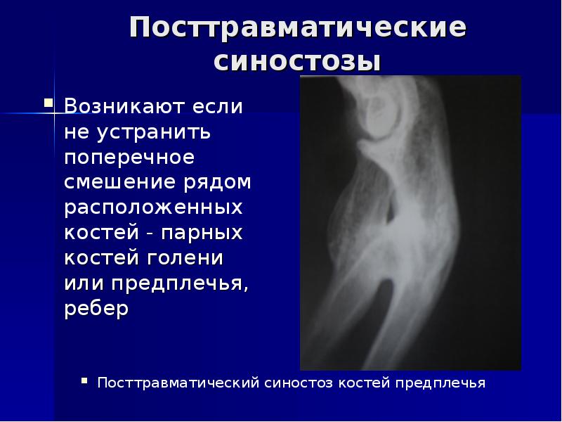 Лучевая диагностика костей презентация