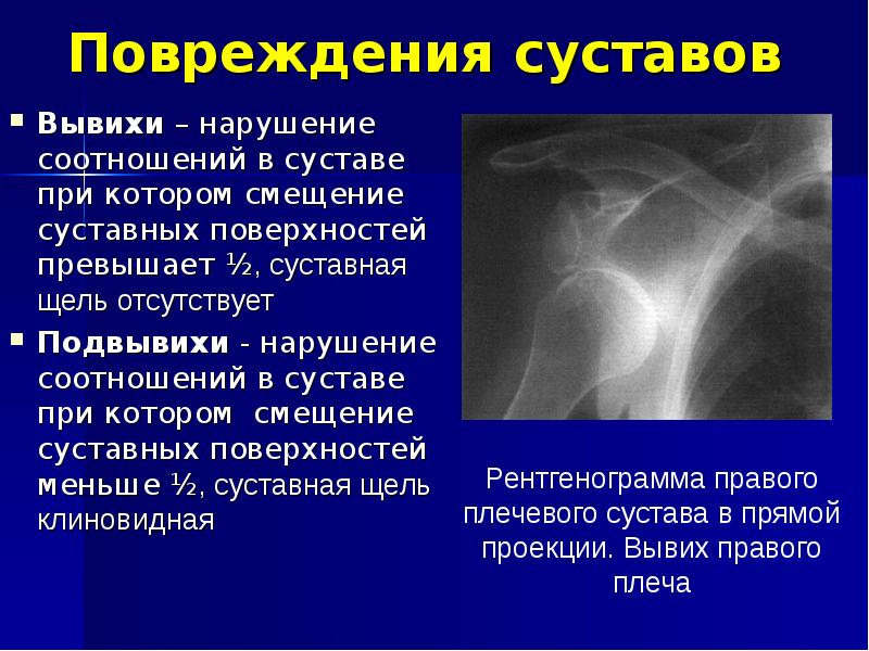 Диагностика механических травм презентация