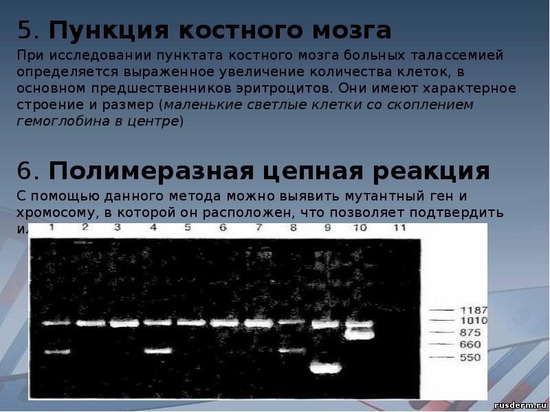 Сигнал от костного мозга неоднородный. Пунктата костного мозга. Цитогенетические исследования пункции костного мозга.