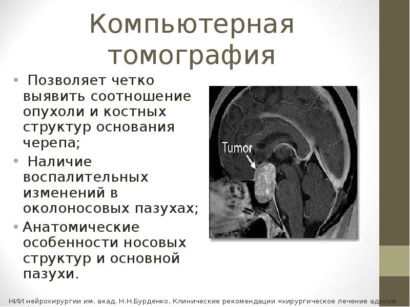 Мр картина объемного образования гипофиза