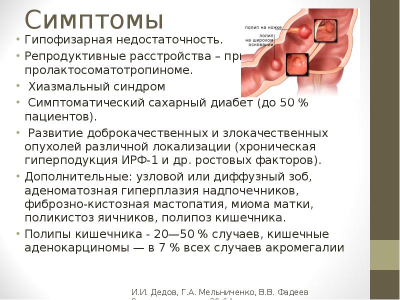 Что значит заключение мр картина микроаденомы гипофиза