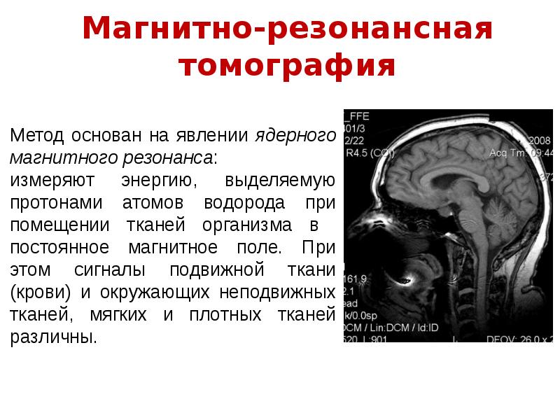 Магнитно резонансная томография презентация