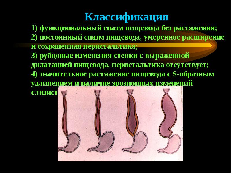 Заболевания и повреждения пищевода презентация