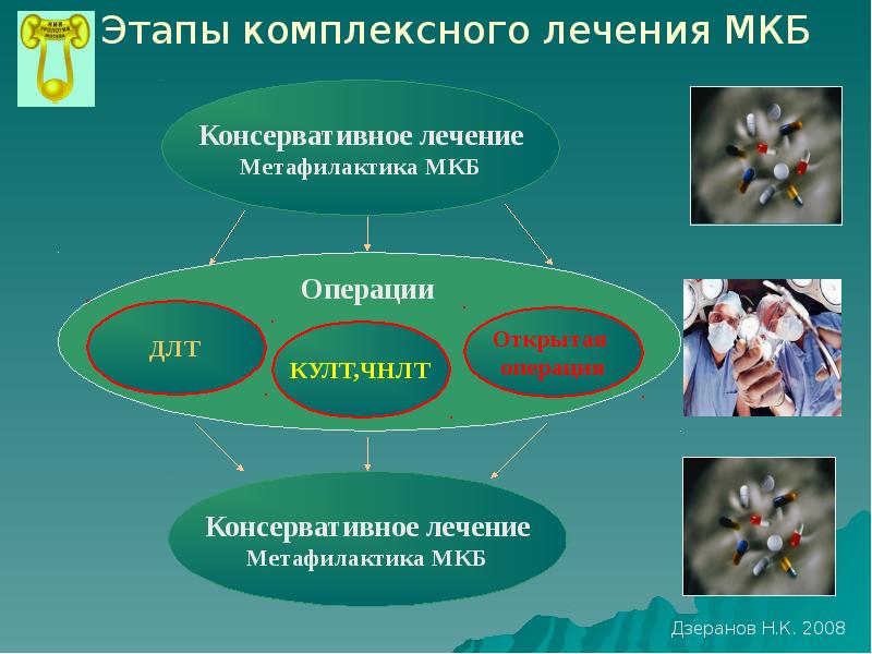 Лечение мочекаменной болезни презентация