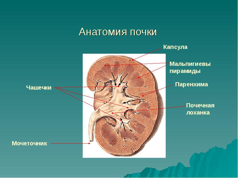 Лечение мочекаменной болезни презентация