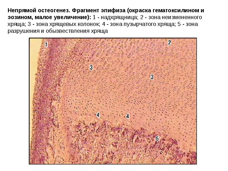 Развитие кости на месте хряща гистология рисунок