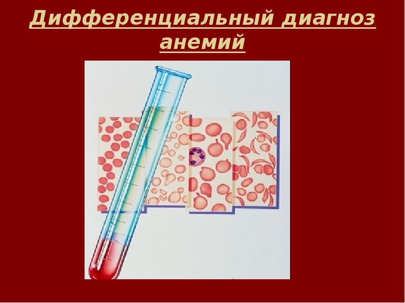 Презентации на тему диагностика анемий thumbnail