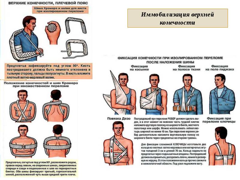 Повреждения плечевого пояса презентация