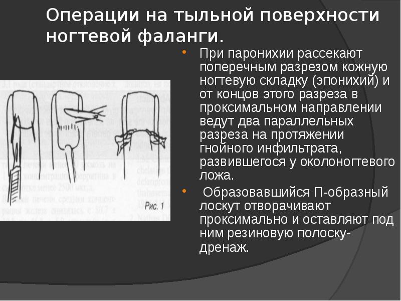 рассмотрите под лупой тыльную поверхность кисти