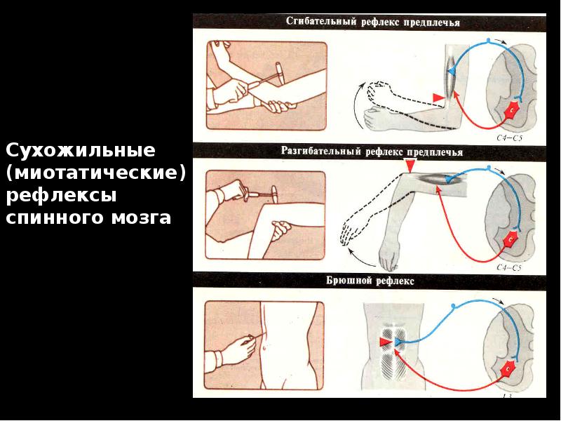 Сухожильные (миотатические) рефлексы спинного мозга