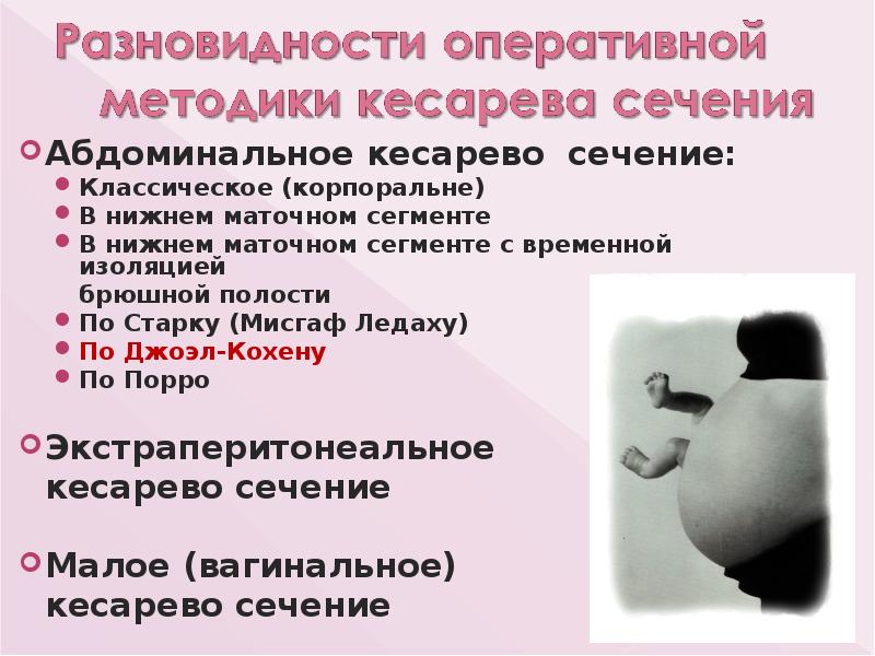 Абдоминальное кесарево сечение:
Абдоминальное кесарево сечение:
Классическое (корпоральне)
В нижнем маточном Абдоминальное кесарево сечение:
Абдоминальное кесарево сечение:
Классическое (корпоральне)
В нижнем маточном