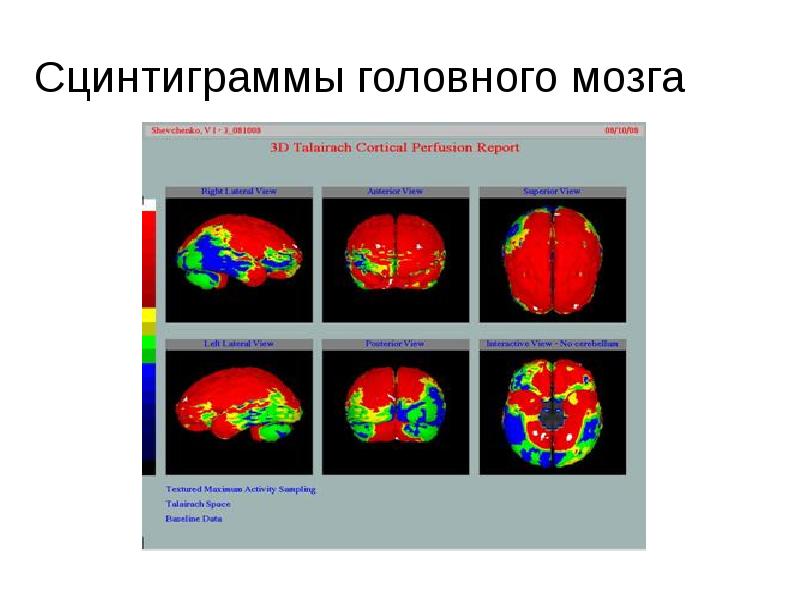 Лучевая диагностика заболеваний головы и шеи презентация