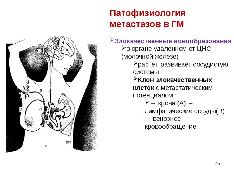 Опухоли нервной системы неврология презентация