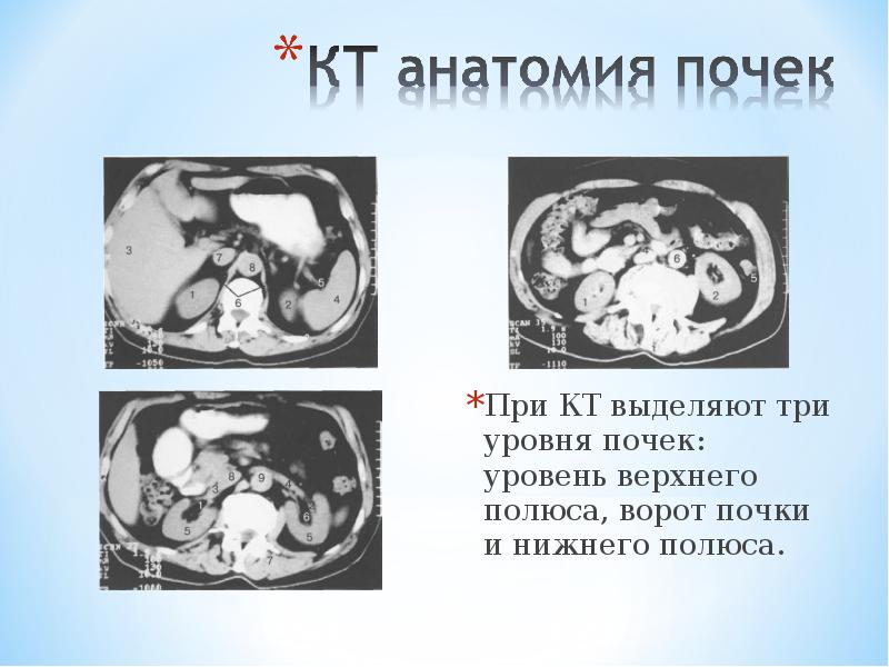 Лучевая диагностика заболеваний почек презентация