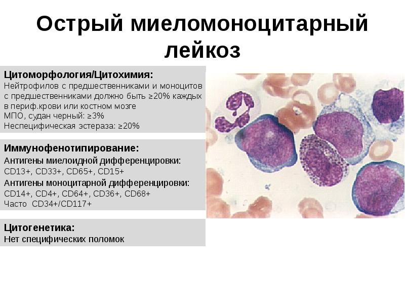 Созылмалы миелолейкоз презентация