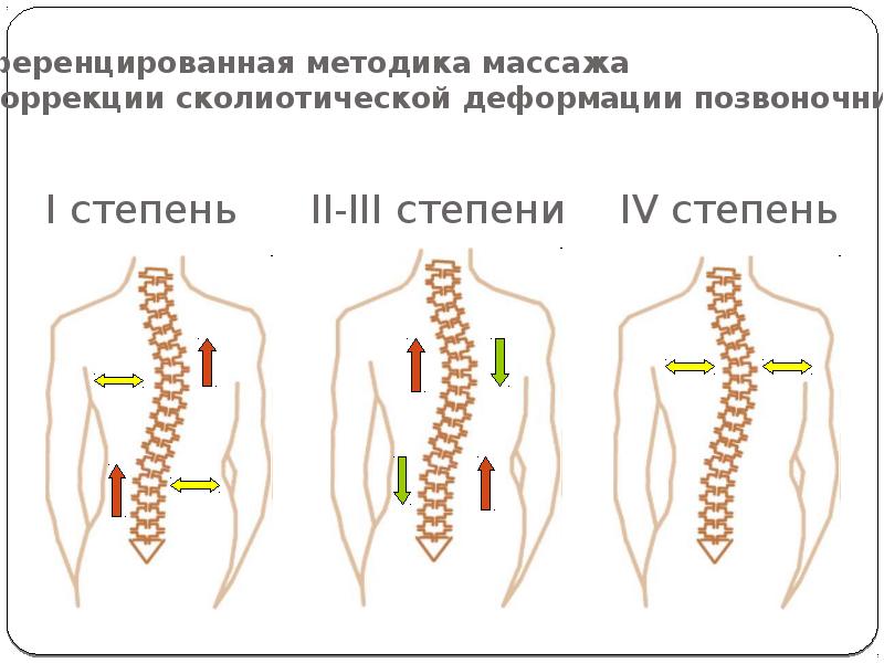 Степени сколиоза в картинках