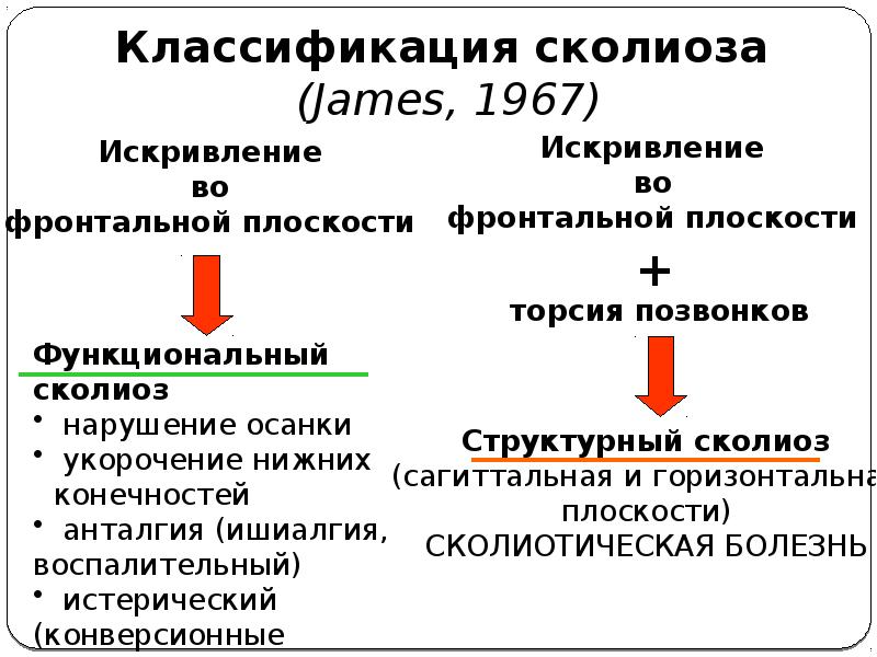 Искривление во фронтальной плоскости