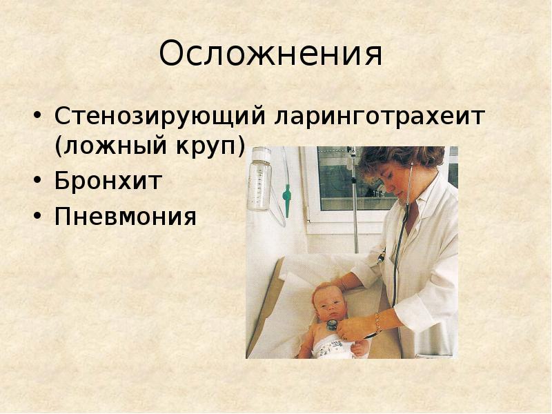 Стенозирующий ларинготрахеит презентация