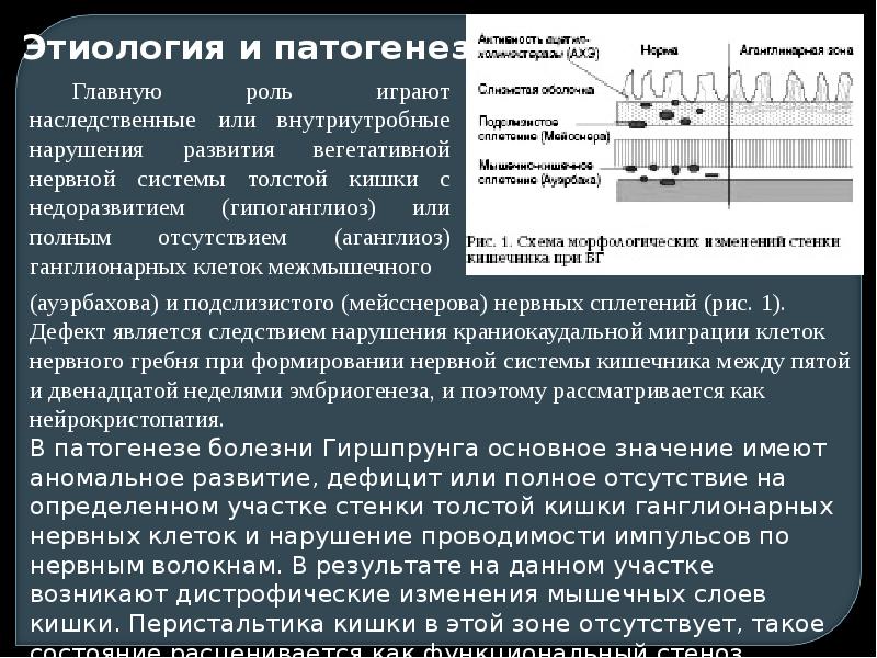 Клиническая картина ректальной формы болезни гиршпрунга характеризуется