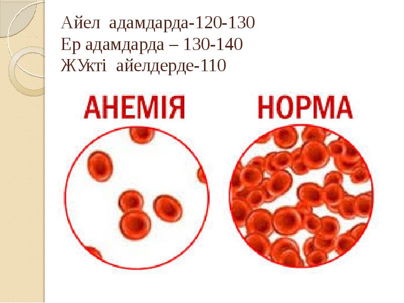 Гемолитикалық анемия қазақша презентация