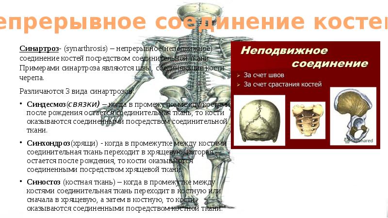 Кости ответ на вопрос